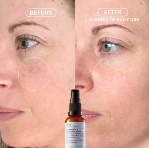 EVOLVE Resveratrol + Niacinamide Serum 10ml - Image 5